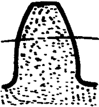 �X݆�����g(sh��)�Zһ�㶨�x